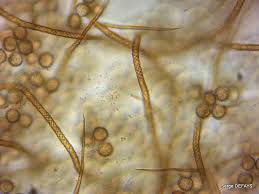 Attēlu rezultāti vaicājumam “Trichia crateriformis”