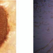 Attēlu rezultāti vaicājumam “Dictydiaethalium plumbeum spores”
