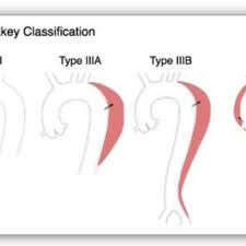 Image result for b%FD%E7ak anatomisi