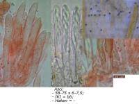 Attēlu rezultāti vaicājumam “Heyderia pusilla”