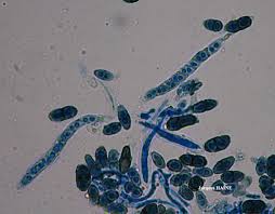 Attēlu rezultāti vaicājumam “Calicium viride”