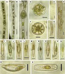 Attēlu rezultāti vaicājumam “Comatricha elegans var. microspora”