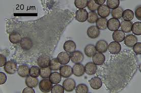 Attēlu rezultāti vaicājumam “Physarum melleum”
