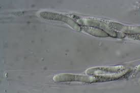 Attēlu rezultāti vaicājumam “Ruzenia spermoides”