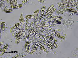 Attēlu rezultāti vaicājumam “Comatricha pulchella spores”