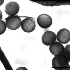 Attēlu rezultāti vaicājumam “Clastoderma debaryanum spores”