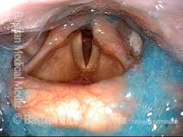 Attēlu rezultāti vaicājumam “Cribraria piriformis stalked”