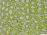 Attēlu rezultāti vaicājumam “Calypogeia azurea cells”