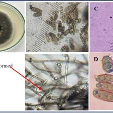 Attēlu rezultāti vaicājumam “Enerthenema papillatum young”