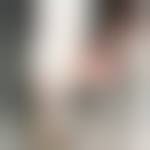 Image result for "proud flesh"