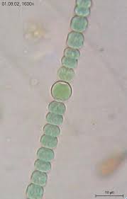 Attēlu rezultāti vaicājumam “Cyanophyta”