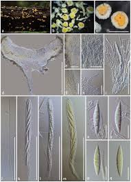 Attēlu rezultāti vaicājumam “Proliferodiscus pulveraceus”