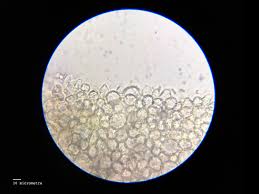 Attēlu rezultāti vaicājumam “Didymium nigripes young”