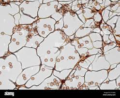 Attēlu rezultāti vaicājumam “Stemonitis splendens spores”