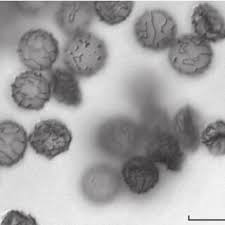 Attēlu rezultāti vaicājumam “Symphytocarpus trechisporus macro”