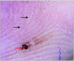Attēlu rezultāti vaicājumam “Cydnidae”