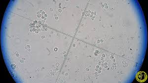 Attēlu rezultāti vaicājumam “Heterobasidion parviporum”