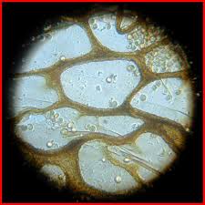 Attēlu rezultāti vaicājumam “Cribraria ferruginea spores”