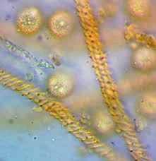 Attēlu rezultāti vaicājumam “Lycogala ustulatum macro”