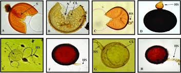 Attēlu rezultāti vaicājumam “Stemonitopsis aequalis var. microspora spores”