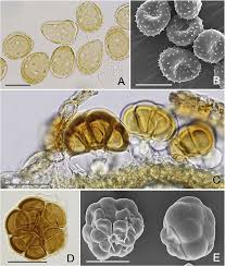 Attēlu rezultāti vaicājumam “Cribraria aurantiaca var. persoonii spores”
