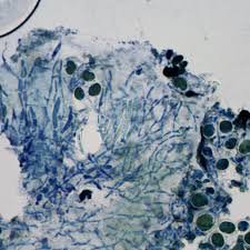 Attēlu rezultāti vaicājumam “Scoliciosporum chlorococcum”