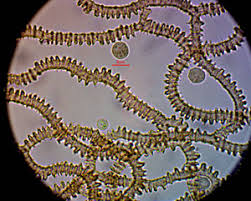 Attēlu rezultāti vaicājumam “Heterotrichia oerstedii (syn. Arcyria oerstedii) sessile”