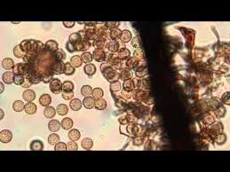 Attēlu rezultāti vaicājumam “Stemonitis marjana spores”