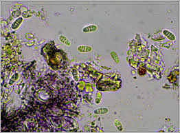 Attēlu rezultāti vaicājumam “Arthonia vinosa”