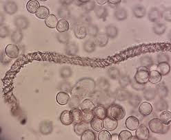 Attēlu rezultāti vaicājumam “Lycogala ustulatum macro”