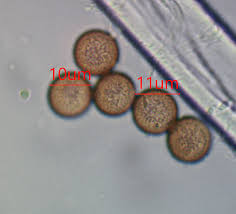 Attēlu rezultāti vaicājumam “Comatricha elegans var. microspora spores”
