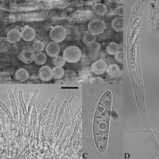 Attēlu rezultāti vaicājumam “Diderma chondrioderma spores”