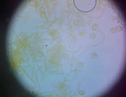 Attēlu rezultāti vaicājumam “Perichaena corticalis spores”