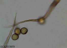 Attēlu rezultāti vaicājumam “Trichia contorta spores”