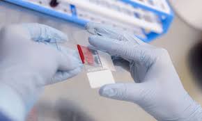 Image result for Hemonetics Superlite