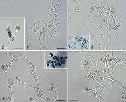 Attēlu rezultāti vaicājumam “Trichia erecta spores”