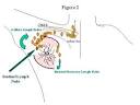 Sentinel Lymph Node Biopsy: What Breast Cancer Patients Need to Know