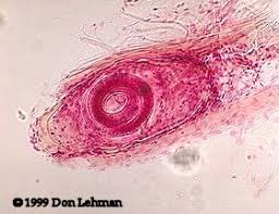 Attēlu rezultāti vaicājumam “Trichia longipalpis spores”
