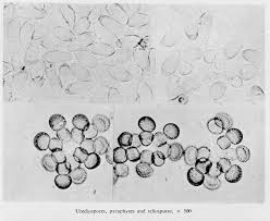 Attēlu rezultāti vaicājumam “Tranzschelia pruni-spinosae spores”