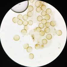 Attēlu rezultāti vaicājumam “Licea pygmaea spores”