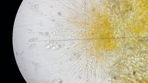 Attēlu rezultāti vaicājumam “Octosporella jungermanniarum”