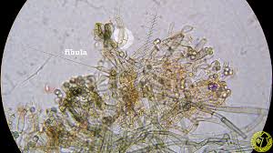 Attēlu rezultāti vaicājumam “Byssocorticium atrovirens”