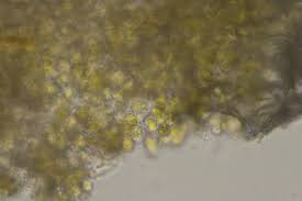 Attēlu rezultāti vaicājumam “Chaenotheca laevigata”