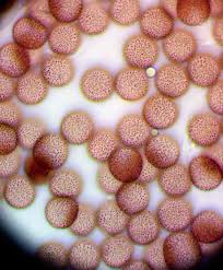 Attēlu rezultāti vaicājumam “Badhamiopsis scripta spores”