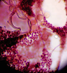 Attēlu rezultāti vaicājumam “Cribraria violacea macro”