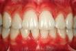 <b>periodontal disease</b> - definition of <b>periodontal disease</b> in the