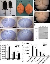 Attēlu rezultāti vaicājumam “Dianema depressum macro”