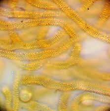 Attēlu rezultāti vaicājumam “Physarum pseudoalexandrowiczii spores”