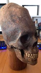 Image result for elongated skulls