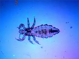 Attēlu rezultāti vaicājumam “Pediculus humanus capitis”